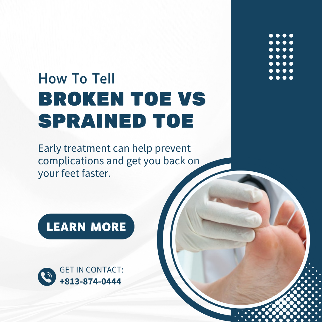 Broken Toe vs Sprained Toe